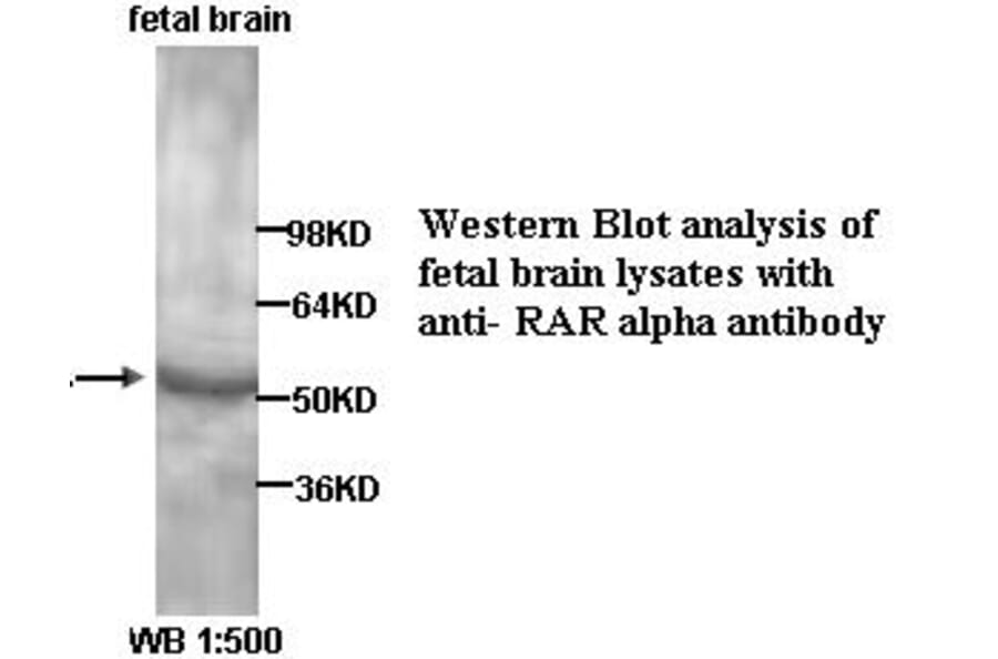 RAR alpha Antibody from Signalway Antibody (39323) - Antibodies.com
