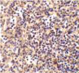 Immunohistochemistry - DNase II Antibody from Signalway Antibody (24046) - Antibodies.com