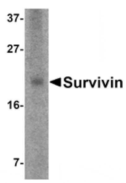 Western blot - Survivin Antibody from Signalway Antibody (24094) - Antibodies.com