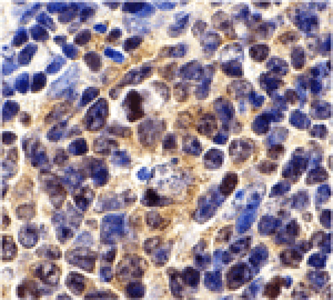 Immunohistochemistry - Survivin Antibody from Signalway Antibody (24094) - Antibodies.com