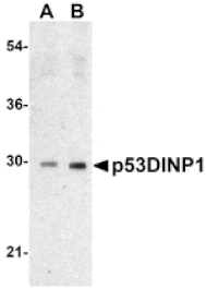 Western blot - p53DINP1 Antibody from Signalway Antibody (24177) - Antibodies.com