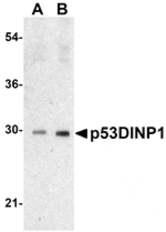 Western blot - p53DINP1 Antibody from Signalway Antibody (24177) - Antibodies.com