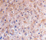 Immunohistochemistry - p53DINP1 Antibody from Signalway Antibody (24177) - Antibodies.com