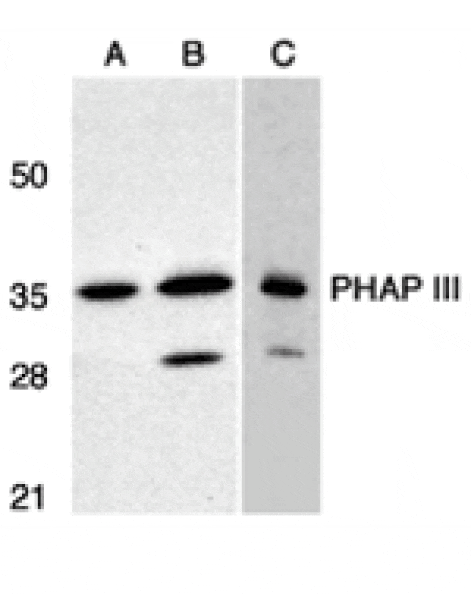 Western blot - PHAP III Antibody from Signalway Antibody (24196) - Antibodies.com