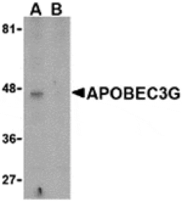 Western blot - APOBEC3G Antibody from Signalway Antibody (24227) - Antibodies.com