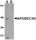 Western blot - APOBEC3G Antibody from Signalway Antibody (24227) - Antibodies.com