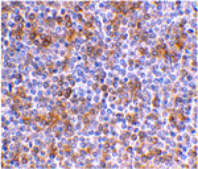 Immunohistochemistry - APOBEC3G Antibody from Signalway Antibody (24227) - Antibodies.com