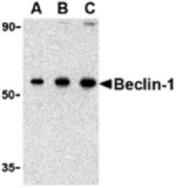 Western blot - Beclin-1 Antibody from Signalway Antibody (24352) - Antibodies.com
