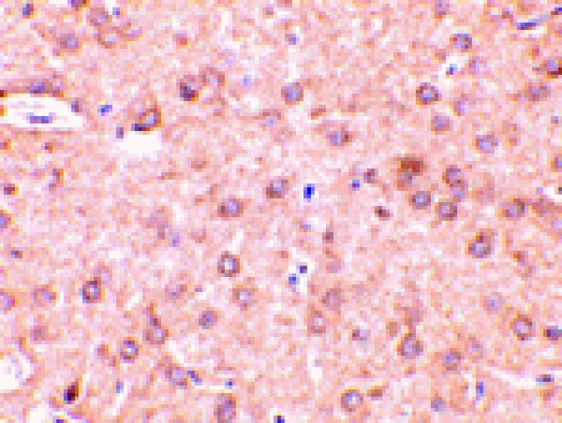 Immunohistochemistry - Beclin-1 Antibody from Signalway Antibody (24352) - Antibodies.com