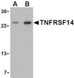 Western blot - TNFRSF14 Antibody from Signalway Antibody (24403) - Antibodies.com