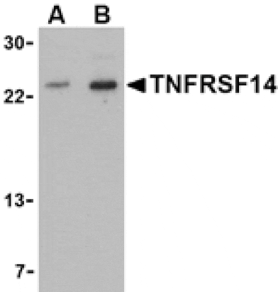 Western blot - TNFRSF14 Antibody from Signalway Antibody (24403) - Antibodies.com