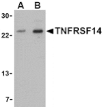 Western blot - TNFRSF14 Antibody from Signalway Antibody (24403) - Antibodies.com