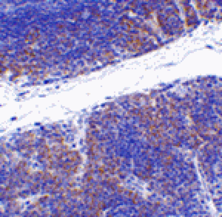 Immunohistochemistry - TNFRSF14 Antibody from Signalway Antibody (24403) - Antibodies.com