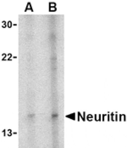 Western blot - Neuritin Antibody from Signalway Antibody (24517) - Antibodies.com