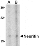 Western blot - Neuritin Antibody from Signalway Antibody (24517) - Antibodies.com