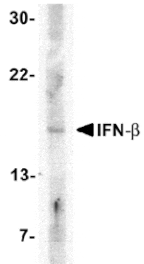 Western blot - IFN-beta Antibody from Signalway Antibody (24540) - Antibodies.com