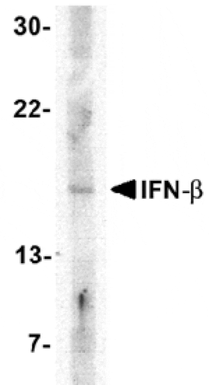 Western blot - IFN-beta Antibody from Signalway Antibody (24540) - Antibodies.com