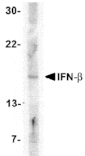 Western blot - IFN-beta Antibody from Signalway Antibody (24540) - Antibodies.com