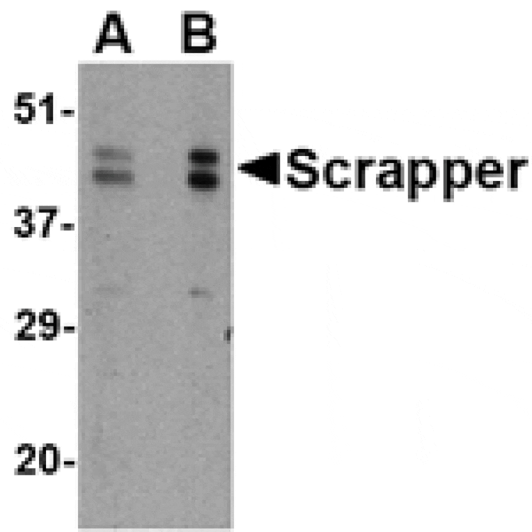 Western blot - SCRAPPER Antibody from Signalway Antibody (24625) - Antibodies.com