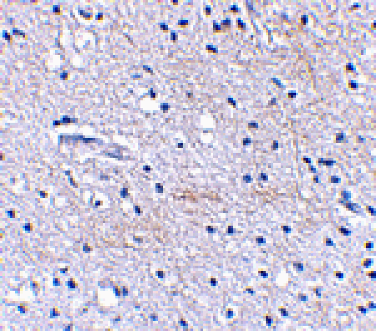 Immunohistochemistry - SCRAPPER Antibody from Signalway Antibody (24625) - Antibodies.com