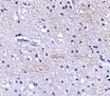 Immunohistochemistry - SCRAPPER Antibody from Signalway Antibody (24625) - Antibodies.com