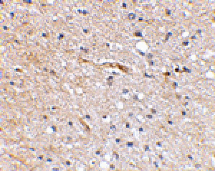 Immunohistochemistry - SCRAPPER Antibody from Signalway Antibody (24626) - Antibodies.com