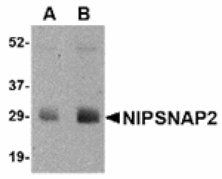 Western blot - NIPSNAP2 Antibody from Signalway Antibody (24803) - Antibodies.com