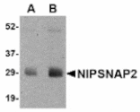 Western blot - NIPSNAP2 Antibody from Signalway Antibody (24803) - Antibodies.com