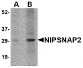 Western blot - NIPSNAP2 Antibody from Signalway Antibody (24808) - Antibodies.com