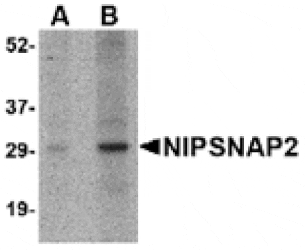Western blot - NIPSNAP2 Antibody from Signalway Antibody (24808) - Antibodies.com
