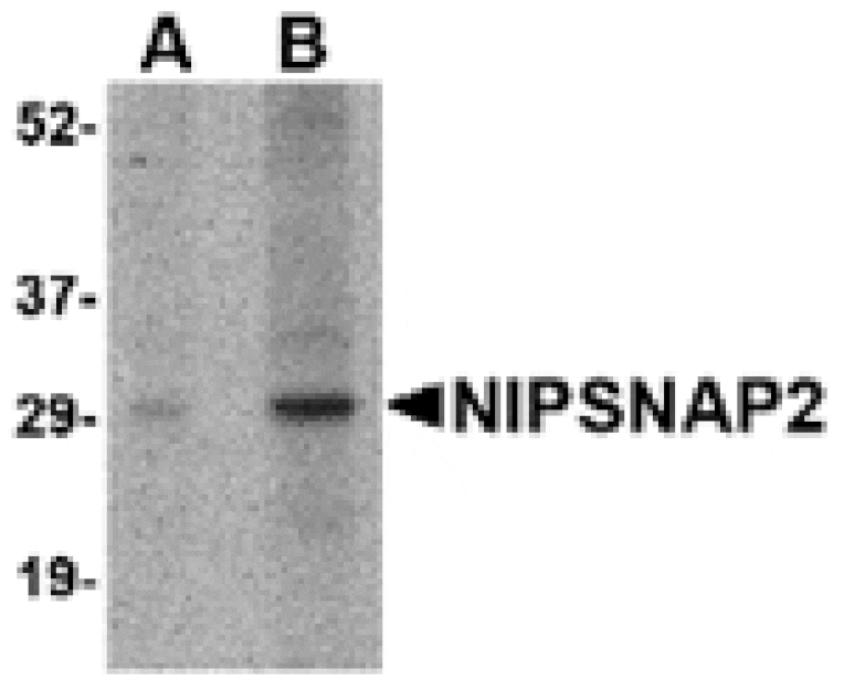 Western blot - NIPSNAP2 Antibody from Signalway Antibody (24808) - Antibodies.com