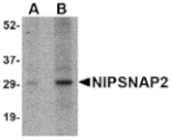 Western blot - NIPSNAP2 Antibody from Signalway Antibody (24808) - Antibodies.com
