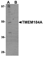 Western blot analysis of TMEM184A in rat brain tissue lysate with TMEM184A antibody at 1 µg/mL in (A) the absence and (B) the presence of blocking peptide.