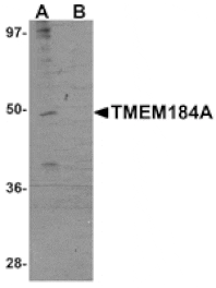 Western blot - TMEM184A Antibody from Signalway Antibody (25089) - Antibodies.com