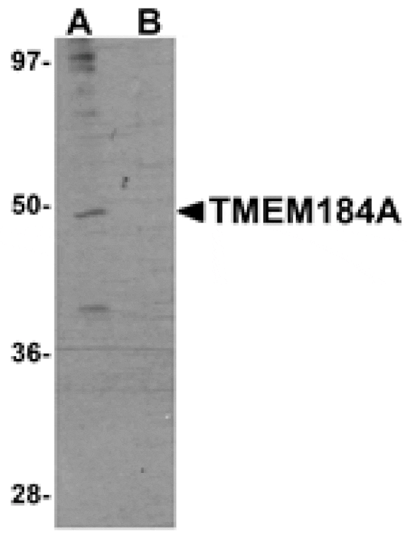 Western blot - TMEM184A Antibody from Signalway Antibody (25089) - Antibodies.com