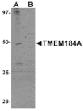 Western blot - TMEM184A Antibody from Signalway Antibody (25089) - Antibodies.com