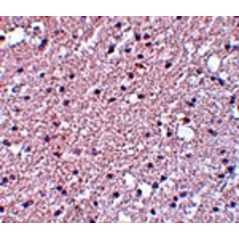 Immunohistochemistry - TMEM184A Antibody from Signalway Antibody (25089) - Antibodies.com