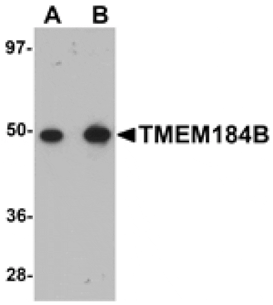 Western blot - TMEM184B Antibody from Signalway Antibody (25090) - Antibodies.com