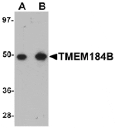 Western blot - TMEM184B Antibody from Signalway Antibody (25090) - Antibodies.com