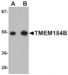 Western blot - TMEM184B Antibody from Signalway Antibody (25090) - Antibodies.com