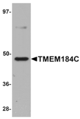 Western blot - TMEM184C Antibody from Signalway Antibody (25091) - Antibodies.com