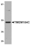 Western blot - TMEM184C Antibody from Signalway Antibody (25091) - Antibodies.com