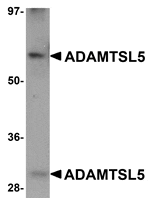 Western blot analysis of ADAMTSL5 in human skeletal muscle tissue lysate with ADAMTSL5 antibody at 1 µg/mL.