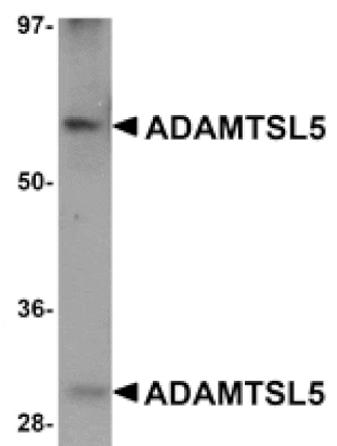 Western blot - ADAMTSL5 Antibody from Signalway Antibody (25092) - Antibodies.com