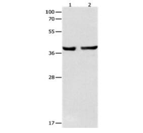 SERPINB5 Antibody from Signalway Antibody (31098) - Antibodies.com