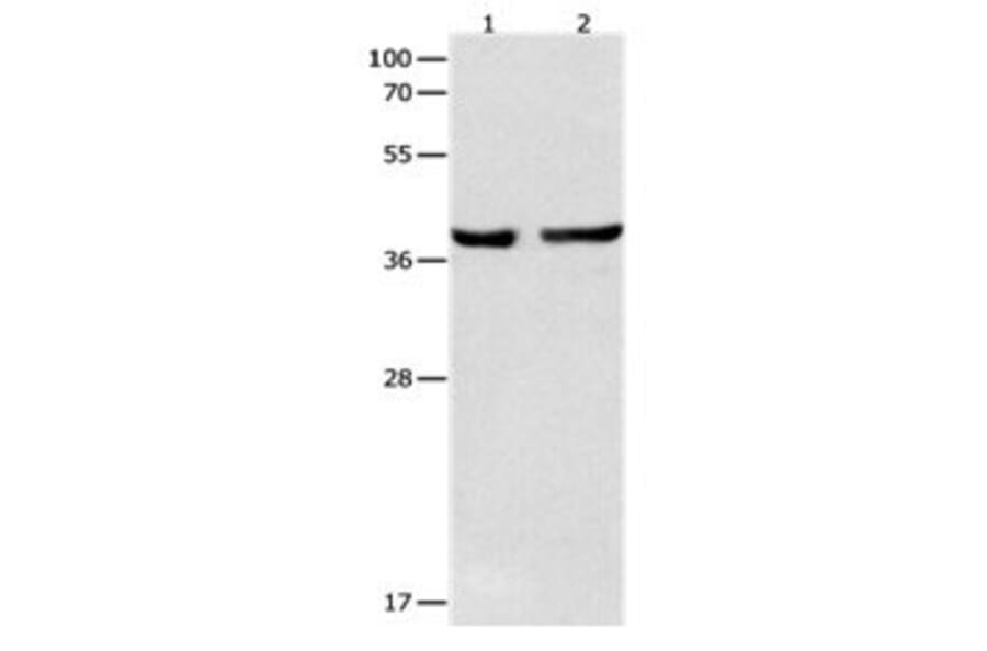 SERPINB5 Antibody from Signalway Antibody (31098) - Antibodies.com