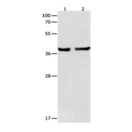 SERPINB5 Antibody from Signalway Antibody (31098) - Antibodies.com