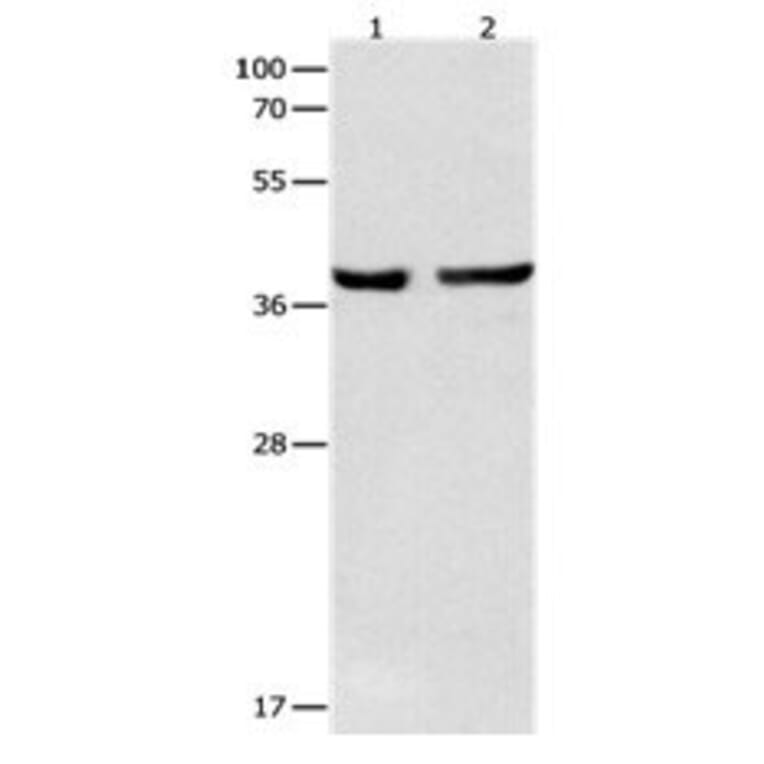 SERPINB5 Antibody from Signalway Antibody (31098) - Antibodies.com
