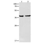 SERPINB5 Antibody from Signalway Antibody (31098) - Antibodies.com
