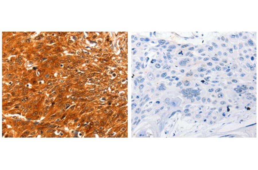 SERPINB5 Antibody from Signalway Antibody (31098) - Antibodies.com